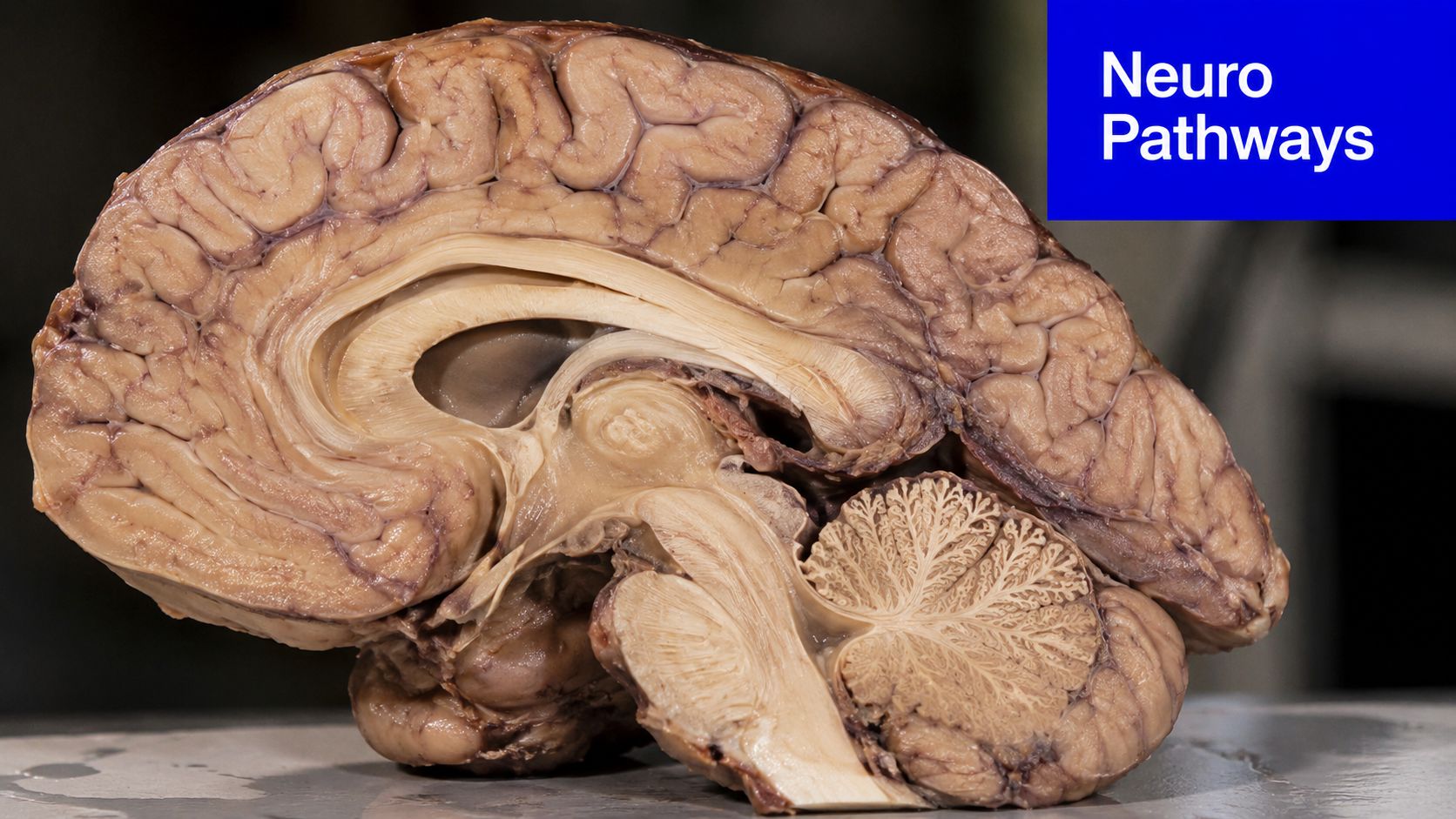 A detailed cross-section view of a human brain specimen showing internal structures and gray matter.