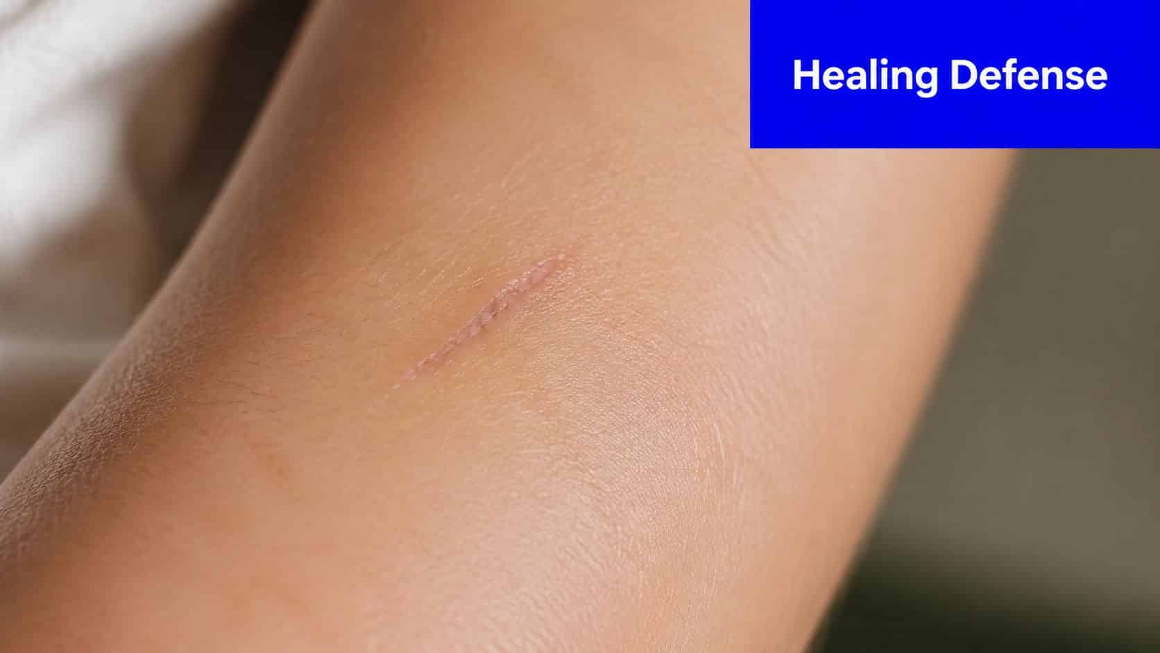 A close-up view of a light linear scar on a person's smooth arm skin.